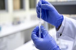 موارد ابتلا به آنفلوآنزا و نوروویروس در آمریکا افزایش یافت