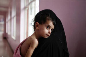 شناسایی 962 کودک دچار سوءتغذیه در مناطق محروم گیلان