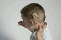 خدمات کاشت حلزون تحت پوشش صندوق حمایت از بیماران صعب العلاج چگونه است؟
