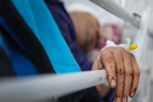 انجام ٧٩ عمل جراحی موفق در روز اول حادثه بندر شهید رجایی در بیمارستان نیروی دریایی ارتش