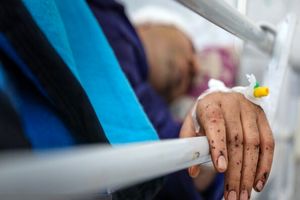 انجام ٧٩ عمل جراحی موفق در روز اول حادثه بندر شهید رجایی در بیمارستان نیروی دریایی ارتش