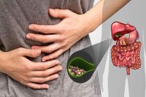 خوراکی‌های خوب و بد برای کیسه صفرا