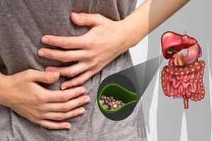 خوراکی‌های خوب و بد برای کیسه صفرا