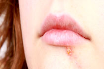 آیا می دانید چرا زخم سرد می زنیم