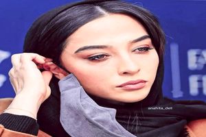 تغییر چهره عجیب آناهیتا درگاهی / همسر اشکان خطیبی یه شبه پیر و شکسته شد